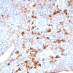 Formalin-fixed, paraffin embedded human tonsil sections stained with 100 ul anti-Lambda Light Chain (clone LAM03) at 1:100. HIER epitope retrieval prior to staining was performed in 10mM Citrate, pH 6.0.